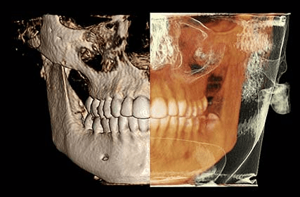 Code Beam 3-D X-ray