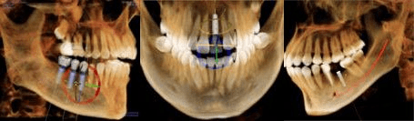2-D Image of Teeth