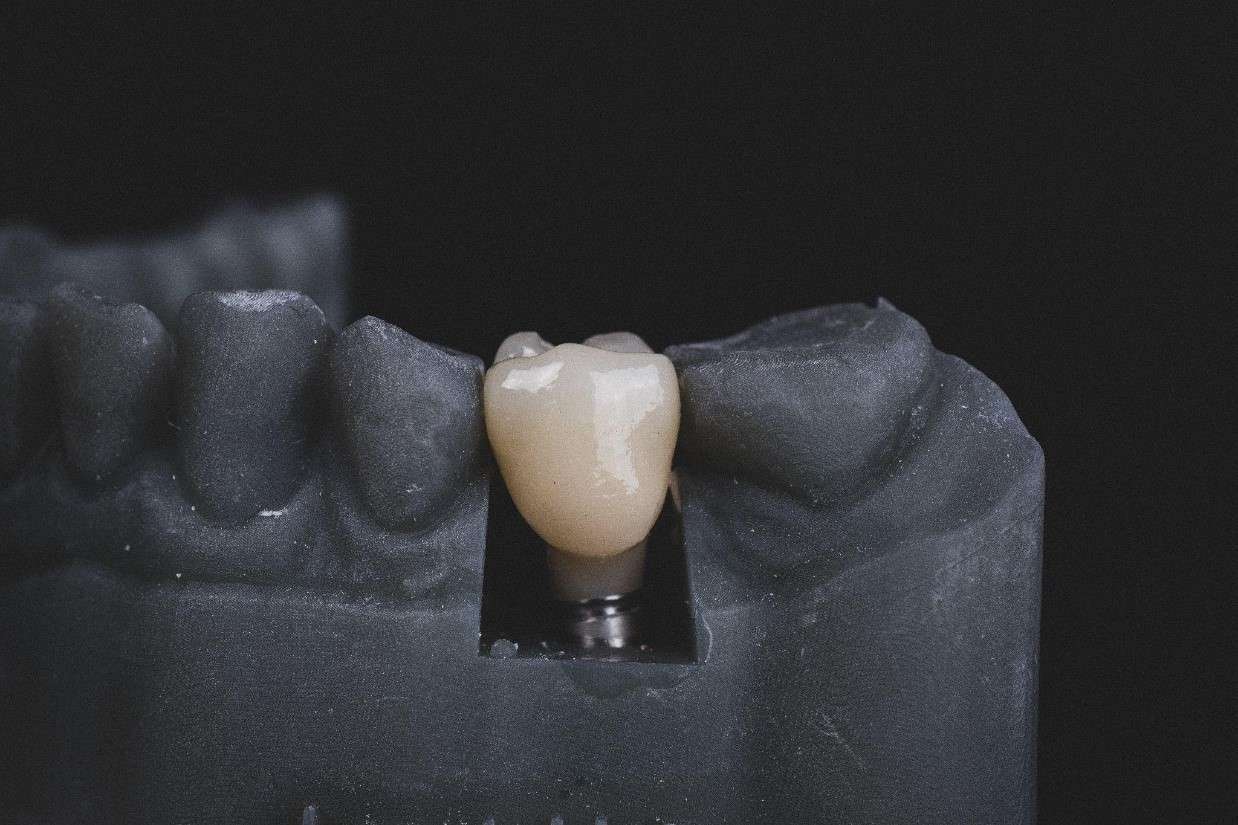 Implant Failure