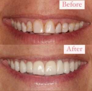 dental care before and after