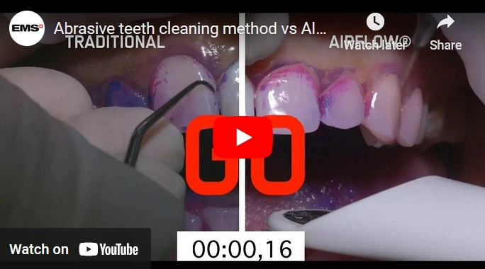 Abrasive teeth cleaning method vs AIRFLOW method